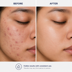 Niacinamide 10% Face Serum with Zinc PCA
