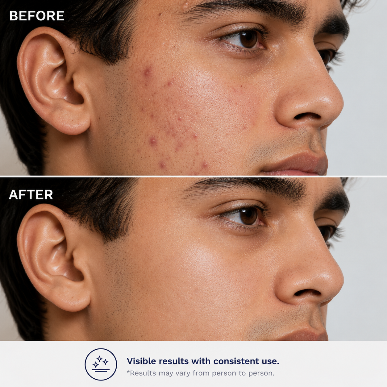Niacinamide 10% Face Serum with Zinc PCA